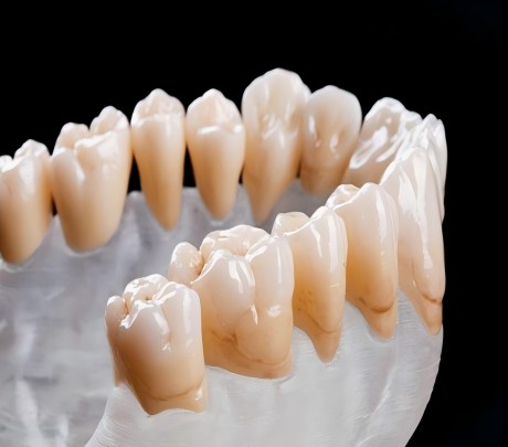 Fixed Denture Series