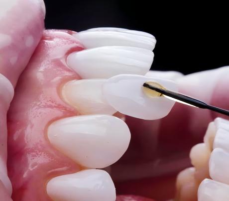 Zirconia blank/ colorful/ multilayer