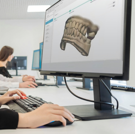STEP2: CAD/CAM design