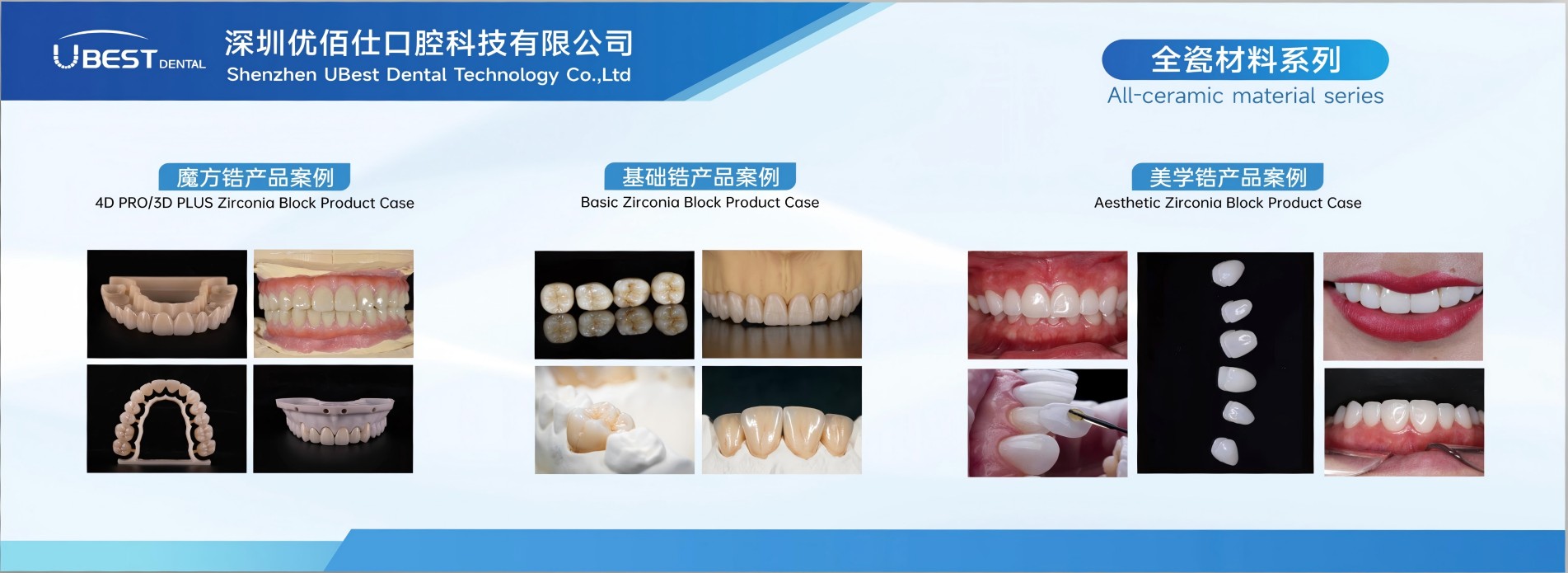 Ubest Dental product family