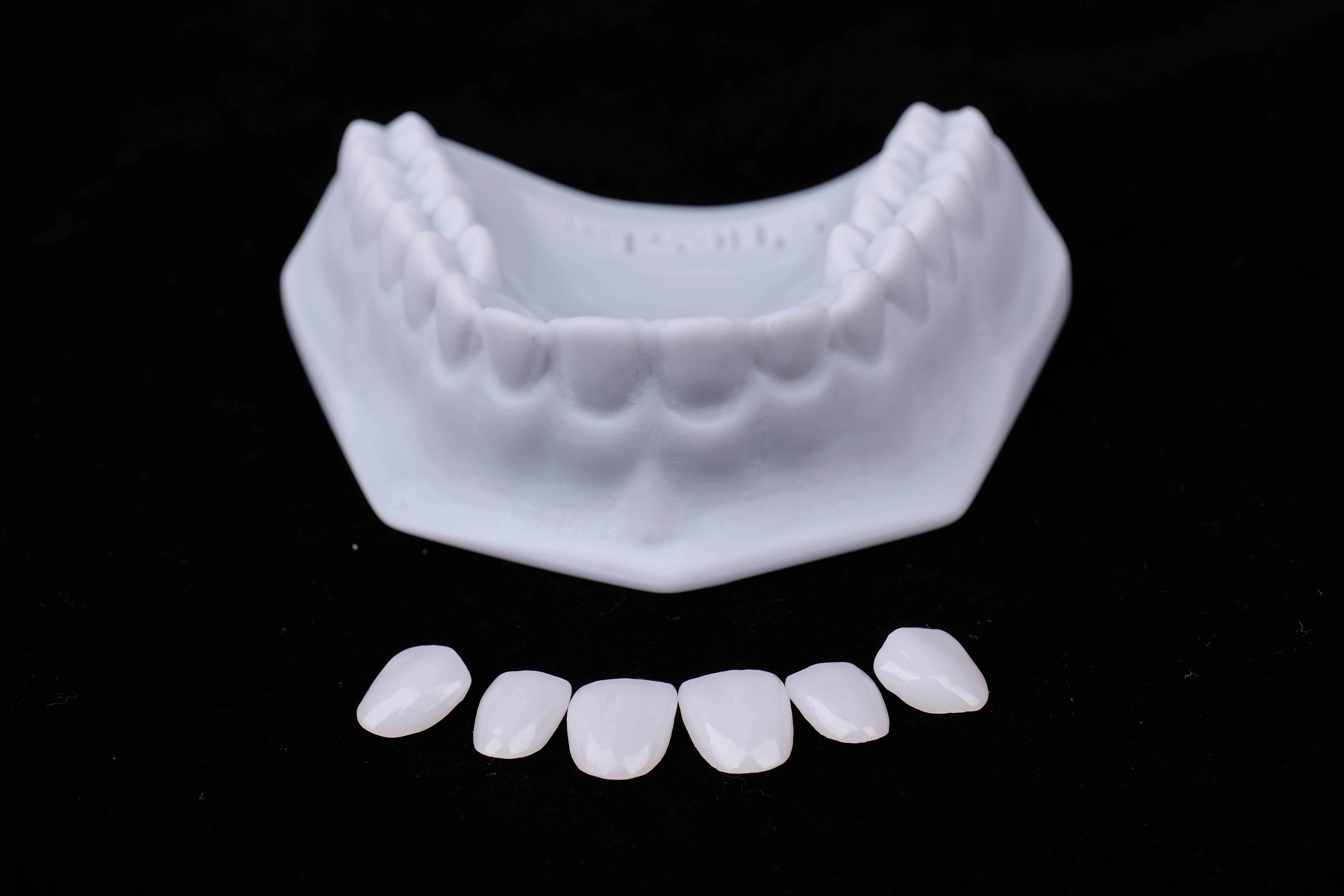 Full glass ceramic  veneer/ inlay/ onlay
