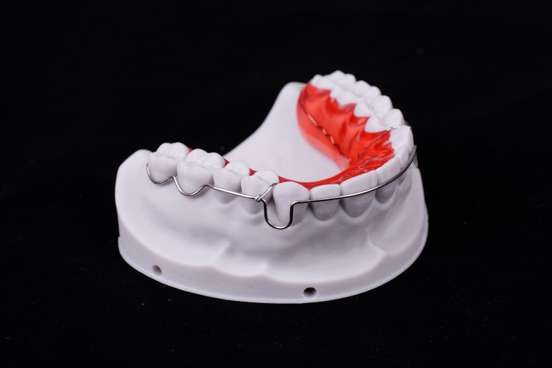 Orthodontics: Begg Retainer