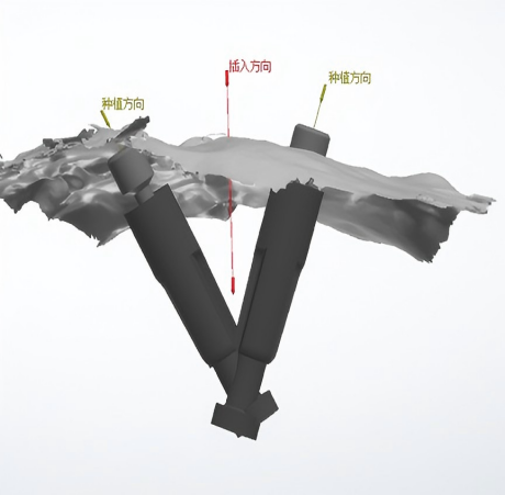 bar slip + special customized individual abutment solution